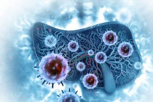 سرطان الكبد | الأنواع وكيفية التشخيص وطرق العلاج المختلفة