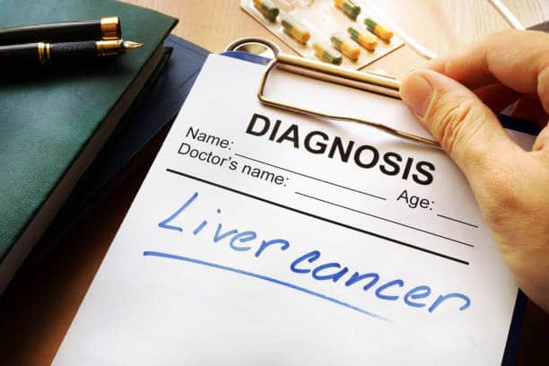 كيف يتم تشخيص سرطان الكبد؟