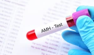 لماذا يطلب الأطباء تحليل AMH؟ مع كيفية قراءة التحليل في المنزل